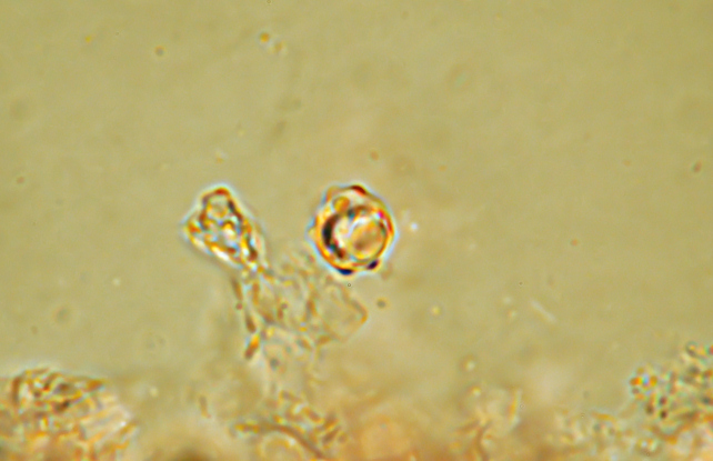 Mycenella sp. e nuove prove di microfotografia
